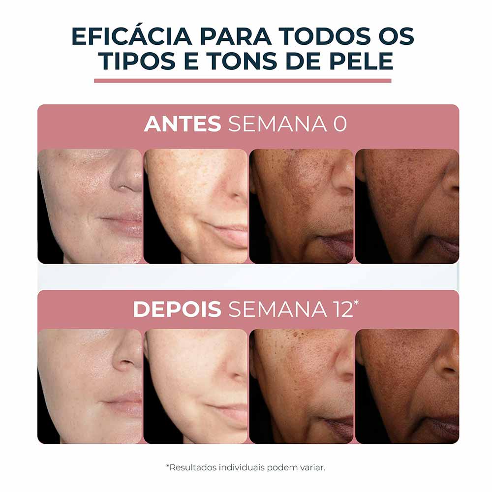 Eucerin Anti-pigment Clareador Creme Facial Dia FPS 30 50ml